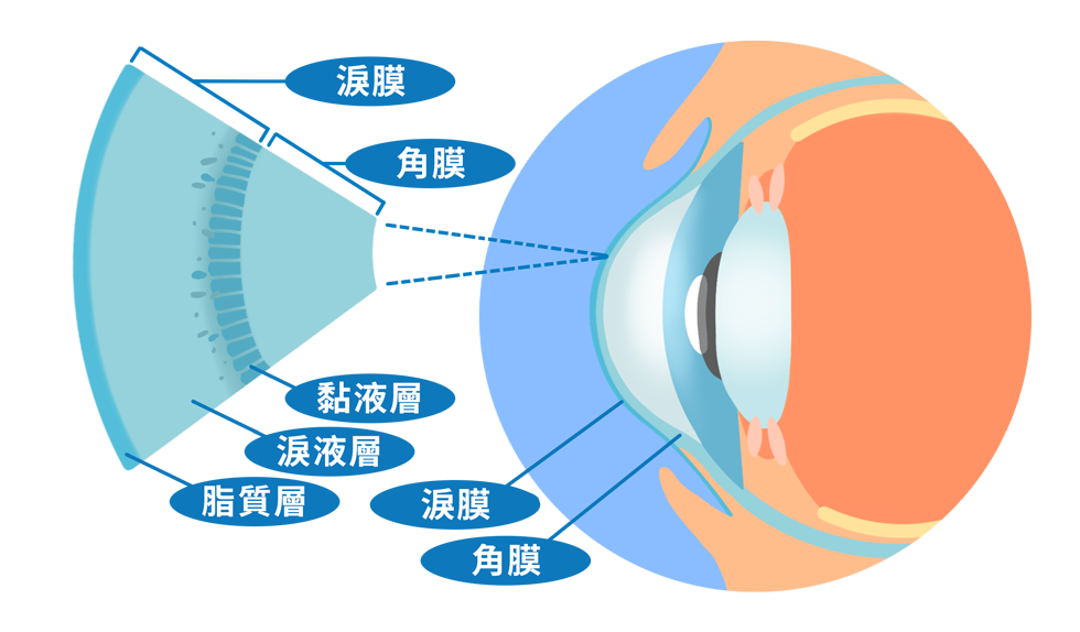 ecd_dry_eye_syndrome_know